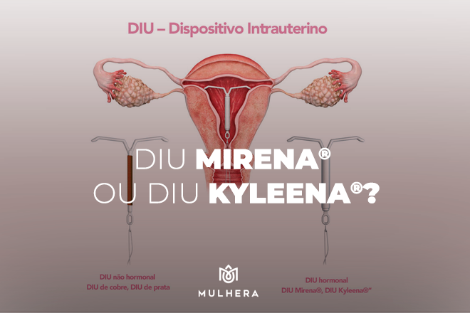 DIU Mirena® ou DIU Kyleena®