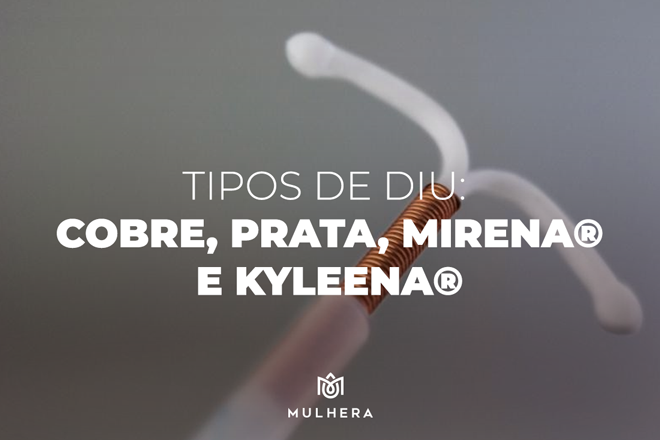Tipos de DIU: cobre, prata, Mirena® e Kyleena®