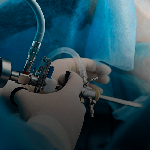 Histeroscopia, cirurgia minimamente invasiva