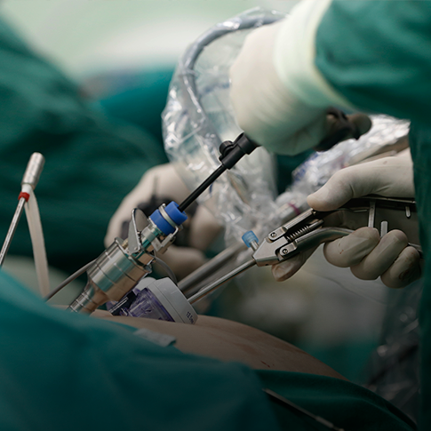 Cirurgia ginecológica. Cirurgia minimamente invasiva, laparoscopia, videolaparoscopia