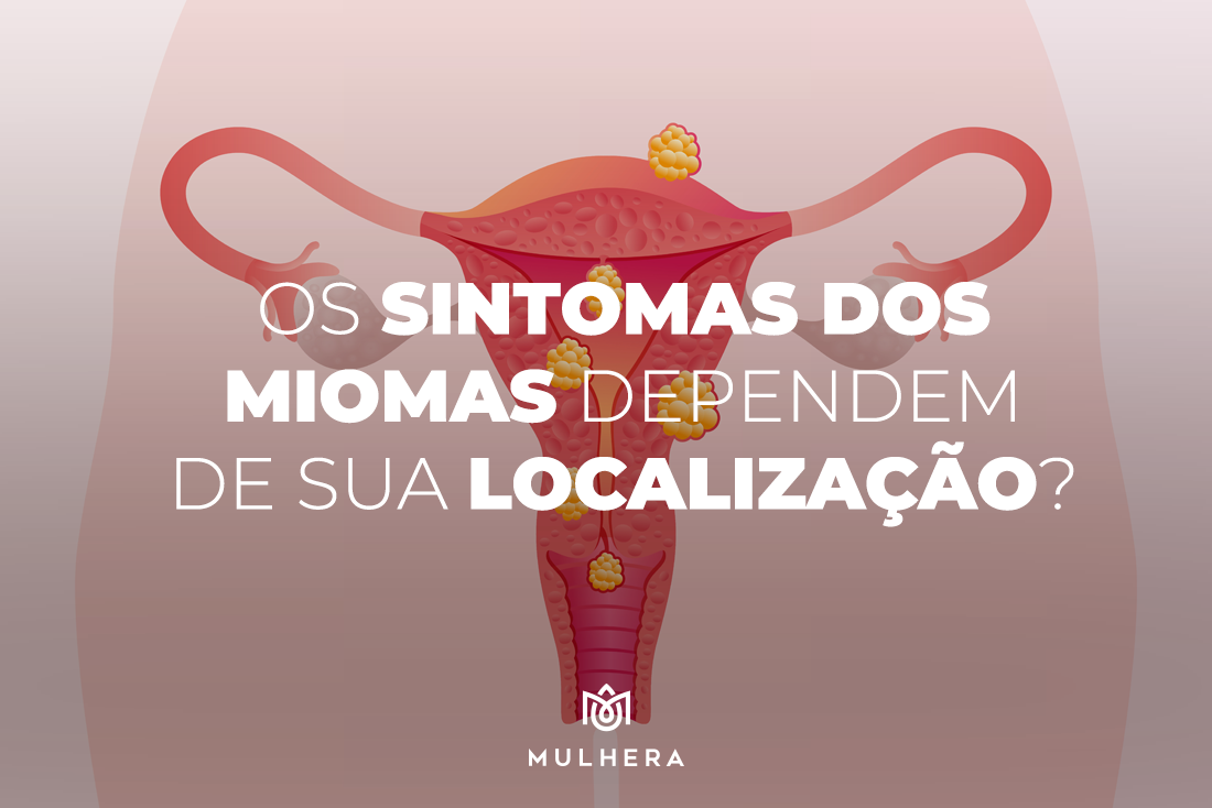 Os sintomas dos miomas dependem de sua localização?