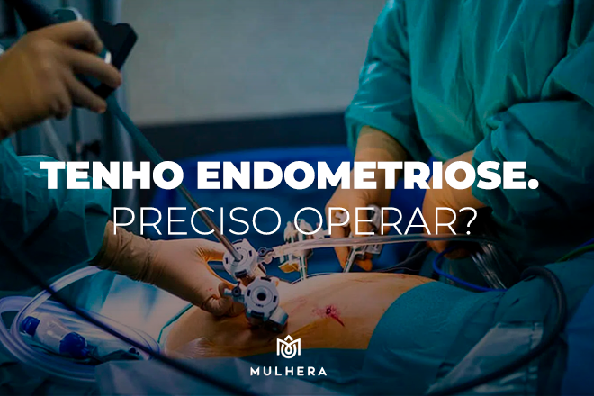 endometriose, preciso operar? Cirurgia da endometriose, histeroscopia
